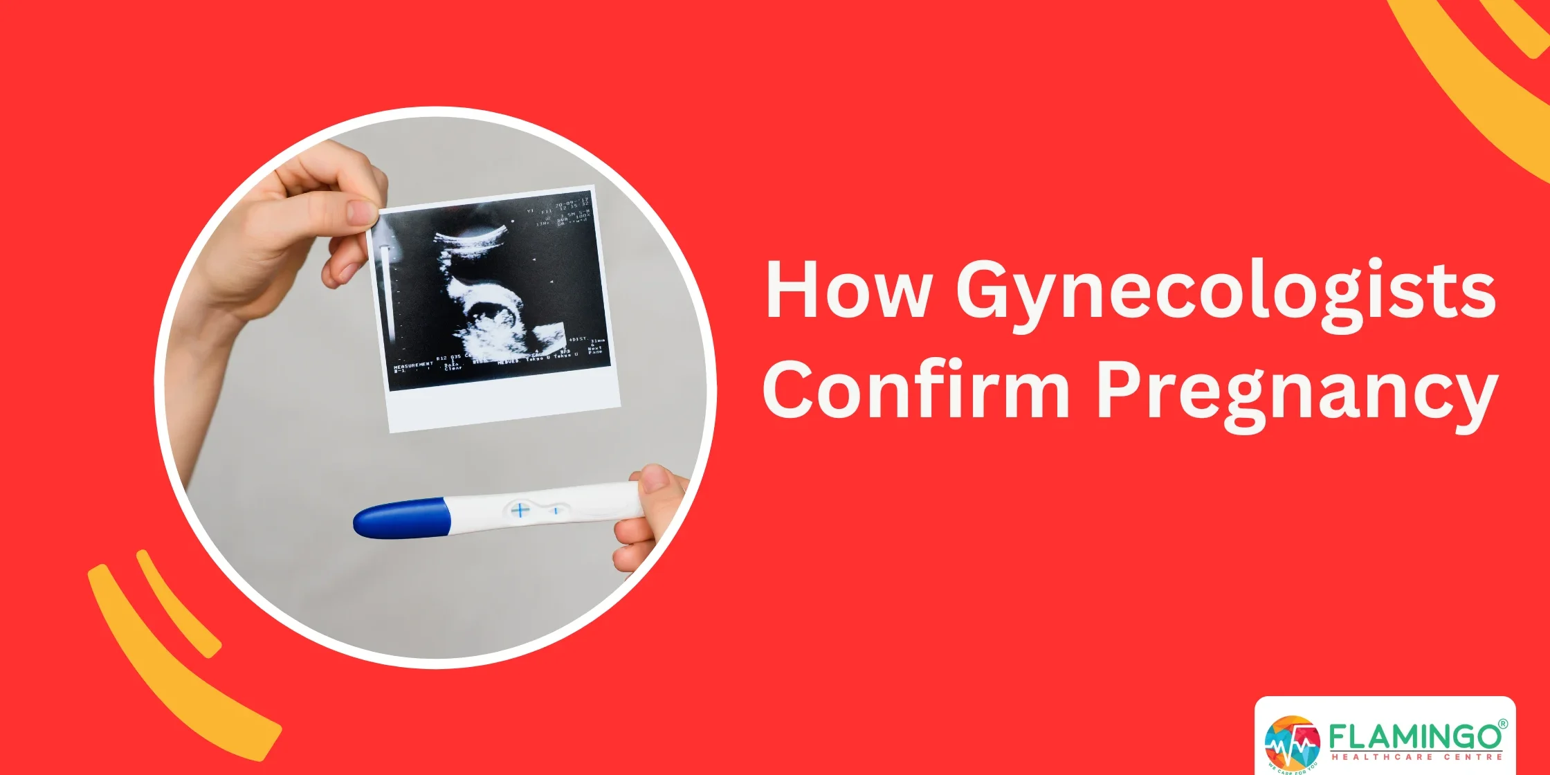 How Gynecologists Confirm Pregnancy